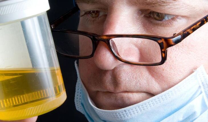 urīna analīze hroniska prostatīta gadījumā